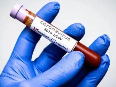 Вопросы и ответы о коронавирусе (COVID-19)