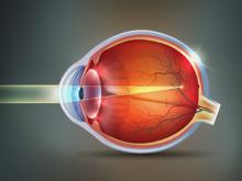 Близорукость (миопия): особенности заболевания