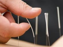 Иглотерапия: иглы