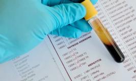 О чем расскажет анализ крови от EML лаборатории?