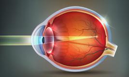 Близорукость (миопия): особенности заболевания