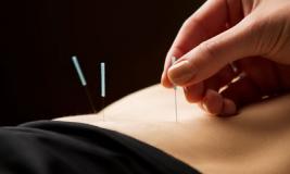 Иглотерапия: на вкус и цвет