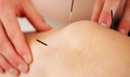 Иглотерапия: горячая точка