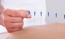 Иглотерапия: целая наука